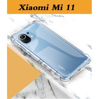 Mi11Lite 5G NE(พร้อมส่งในไทย)เคสใสกันกระแทกคลุมกล้องMi12/Mi12X/PocoX3GT/Redmi Note10Pro 5G/Mi11Ultra/Mi11/Poco F3/PocoM3