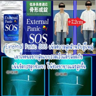 SOS External เพิ่มความสูง เพิ่มส่วนสูงจากญี่ปุ่น