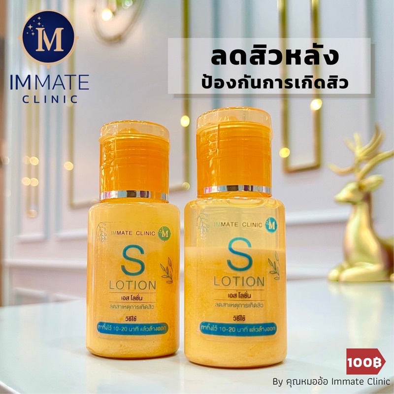 S Lotion โลชั่นลดสาเหตุการเกิดสิวที่หลัง