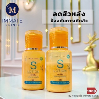 S Lotion โลชั่นลดสาเหตุการเกิดสิวที่หลัง