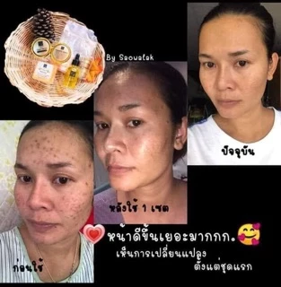 ครีมคริสตัลออร่าสกิน คู่จิ้น เซรั่ม30กรัม+ครีมกลางคืน 15 กรัม 700฿