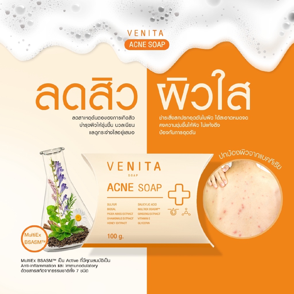 สบู่ลดสิวที่หน้า หลังและก้น VENITA ACNE SOAP 100 g SULPHUR SALICYLIC ...