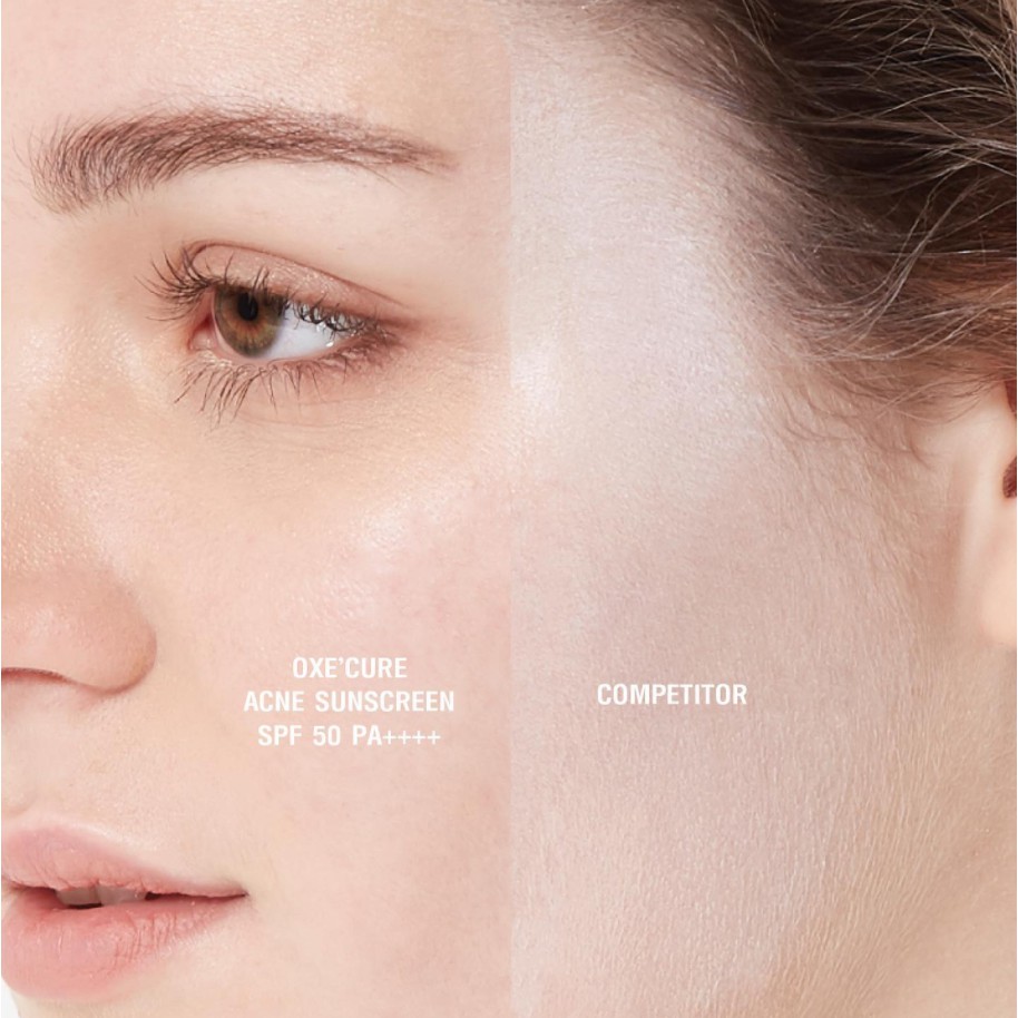 oxecure acne sunscreen