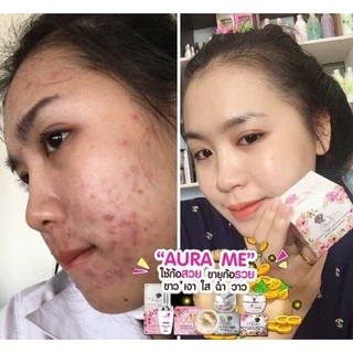 Aura me เพอร์เฟค อาบูติน ไนท์ครีม