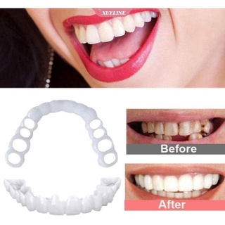 Snap On Smile ฟันปลอมบนและล่าง Perfect Smile สติกเกอร์ฟันปลอมฟันซิลิโคนแม่พิมพ์ฟอกสีฟันจำลองเครื่องมือจัดฟัน-LIXUE