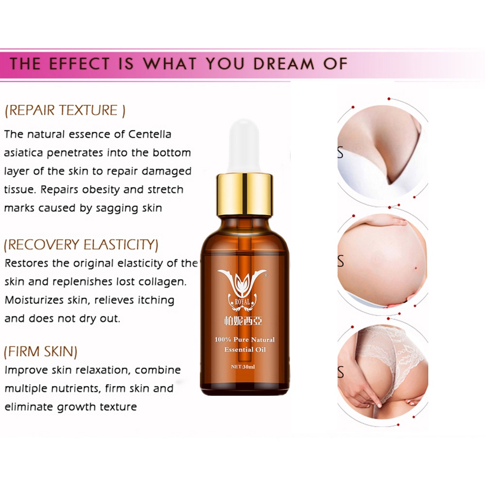 Skin Treatment Oil Remove Puncture Cellulite Stretch Mark Repair Body Care 30ml