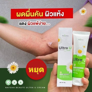 💉ราคาพิเศษ ครีมทาเชื้อรา ผิวหนัง!!! Ultra U อัลตร้ายู ครีม แก้ปัญหาเชื้อรา เล็บเน่า ลดอาการคันได้ทุกจุด 30 g.