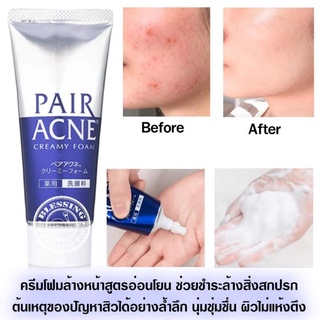 Pair Acne Creamy Foam 80g.
ครีมโฟมล้างหน้าสูตรอ่อนโยน ช่วยชำระล้างสิ่งสกปรก