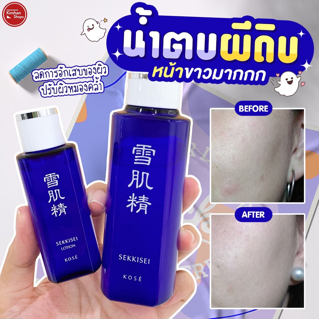 Kose Sekkisei Lotion ไวท์เทนนิ่งโลชั่นอันดับ 1