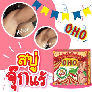 สบู่โอ้โห แก้สิวหลัง สิวผด แก้หลังเป็นสิว ผิวไม่เรียบ OHO Underarm Whitening Saop