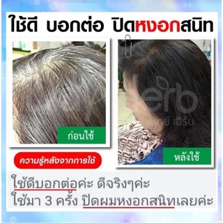 DayHerb แชมพูปิดผมขาว สมุนไพรแท้ ปิดหงอก Day Herb ลดหงอก ผมดำใน 5 นาที