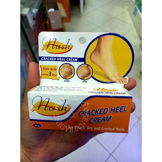 Nash Cracked Heel Cream แนช แครค ฮีลครีม ครีมทาส้นเท้าแตก ครีมบำรุงส้นเท้า บำรุงเท้า เห็นผลชัดเจนใน 3 วัน