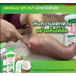 ครีมทาส้นเท้าแตก เท้าแห้งกร้าน เห็นผลชัดเจน  FOOT SPA MIX COCONUT ชุดดูแลสุขภาพเท้า (1ชุดมี3ชิ้น)