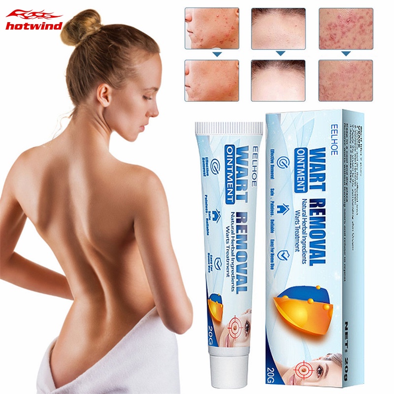 Hw ครีมพลาสเตอร์ทําความสะอาดผิวหน้า กําจัดหูด 20 กรัม สําหรับผู้ชาย และผู้หญิง