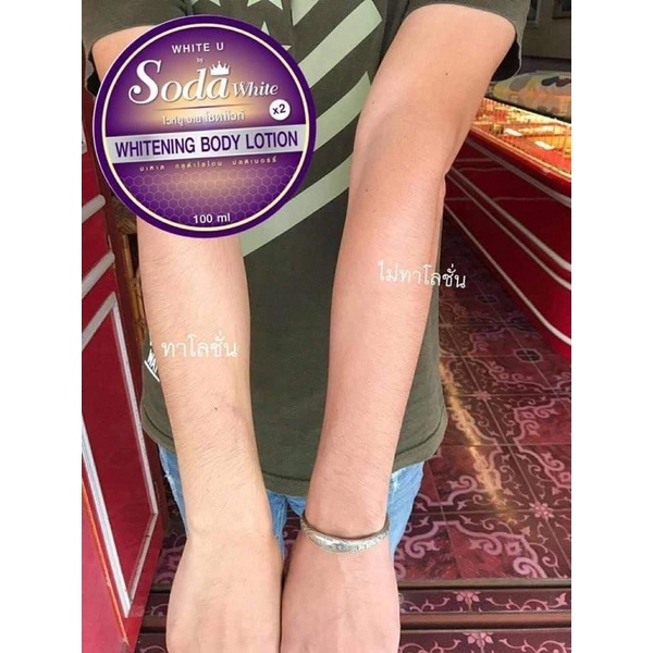 โลชั้นผิวขาว sodawhtie