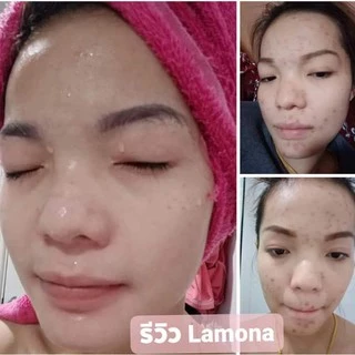 ครีมลาโมน่า ครีมLamona-(มีของแถมน่ารักๆ)