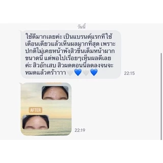 Anti Acne (พร้อมส่ง) แต้มสิวสมุนไพร สิวอักเสบ สิวหนอง สิวผดยุบ! Maertar Anti Acne