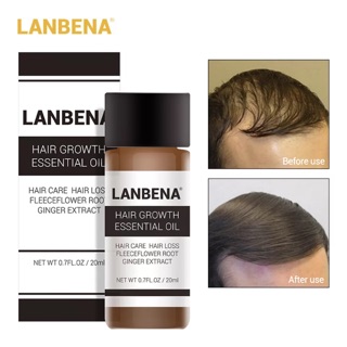 LANBENA ออยล์แก้ปัญหาผมร่วง กระตุ้นการสร้างเส้นผม ผลิตภัณฑ์ดูแลผม 20ml