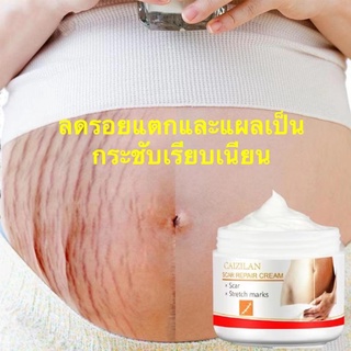 CAIZILAN ครีมลดรอยแตกลาย 30g เรียบริ้วรอย เรียกคืนความยืดหยุ่นของผิว ครีมรอยแตกลาย ครีมทาท้องลาย