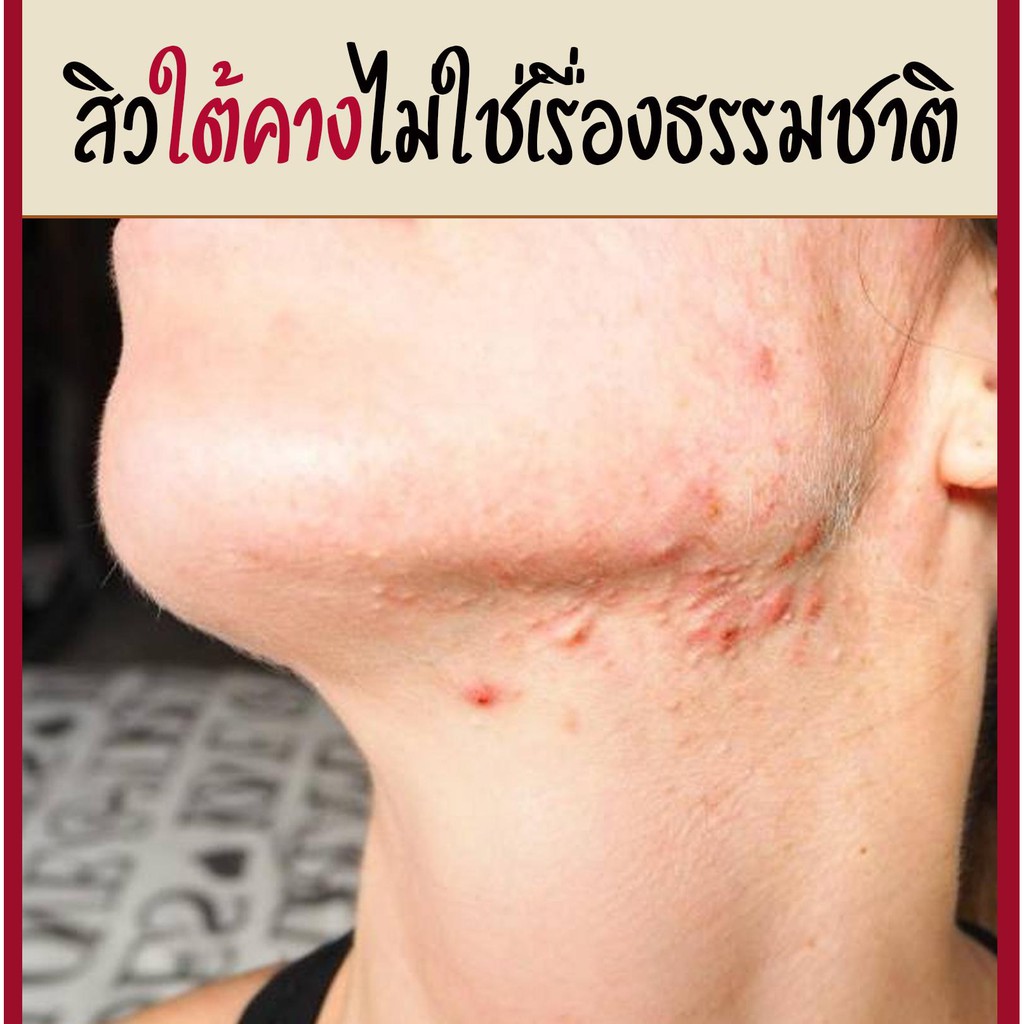 My Image 33