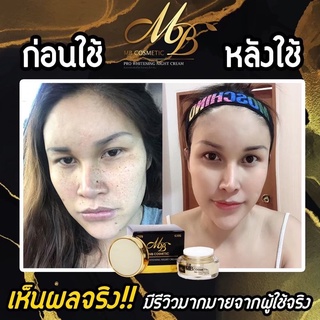 MB COSMETIC PRO WHITENING CREAM เอ็มบี คอสเมติกส์ โปร ไวน์เทนนิ่ง ครีม