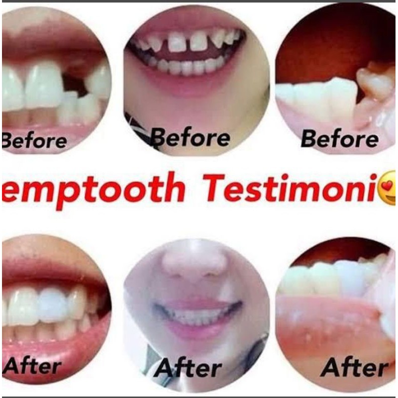 กาวติดฟันปลอม / Temptooth / Make Yourself ghoslime.th ThaiPick