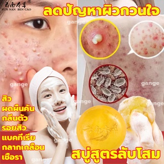 สบู่กำจัดไร 100g สบู่กำจัดไรสิว สบู่กำจัดสิว สบู่ลดสิวหน้า ไวท์เทนนิ่ง สบู่สูตรลับโสม สบู่อาบน้ำ สบู่ล้างเครื่องสำอางค์