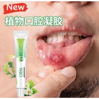 ของแท้100% ครีมทาแผลในปาก แผลร้อนใน ครีมต้านแบคทีเรีย เพื่อสุขภาพช่องปากที่แข็งแรง