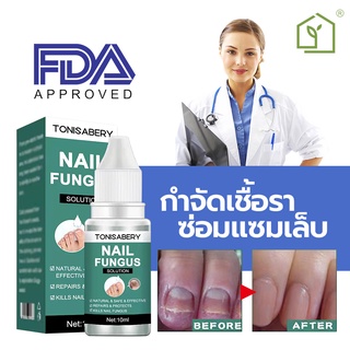 ❤TONISABERY❤ รักษาเชื้อราที่เล็บ ซ่อมแซมโรคเชื้อราที่เล็บ เซรั่มเล็บ เล็บขบ เซรั่มรักษาเล็บ ยาฆ่าเชื้อรา 20g