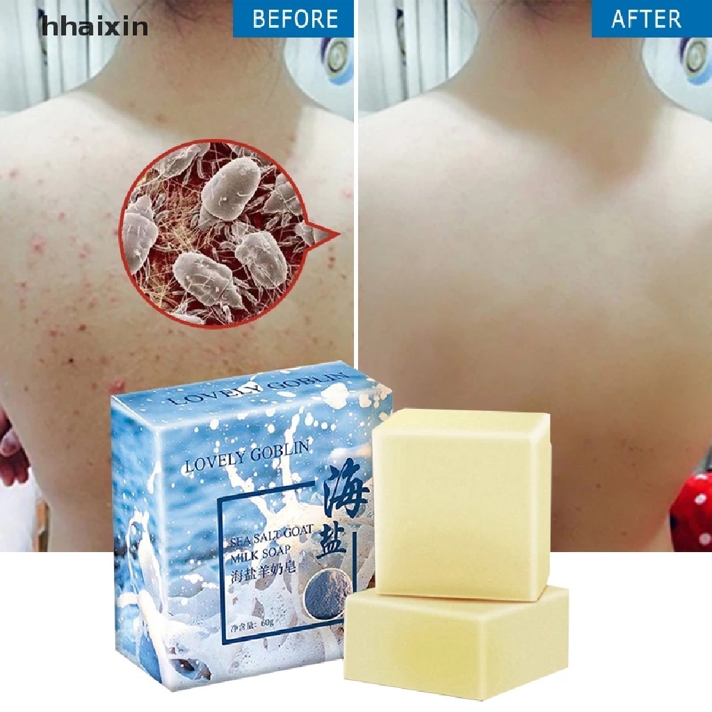 [HaiHai] Sea Salt Soap Removal Pimple Pore Acne Treatment Goat Milk Soap 
 Boutique #6