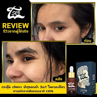 T-SER เซรั่ม ปลูกคิ้ว ปลูกผม ปลูกหนวด เครา 25ml.(1ขวด)📌