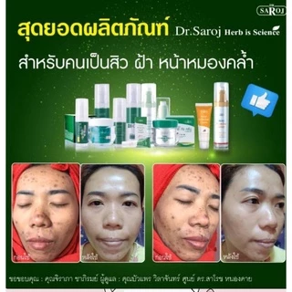 ดร.สาโรช ไฮโกล โลชั่น รักษาฝ้า สำหรับ หน้ามันมาก x2 Hi glow