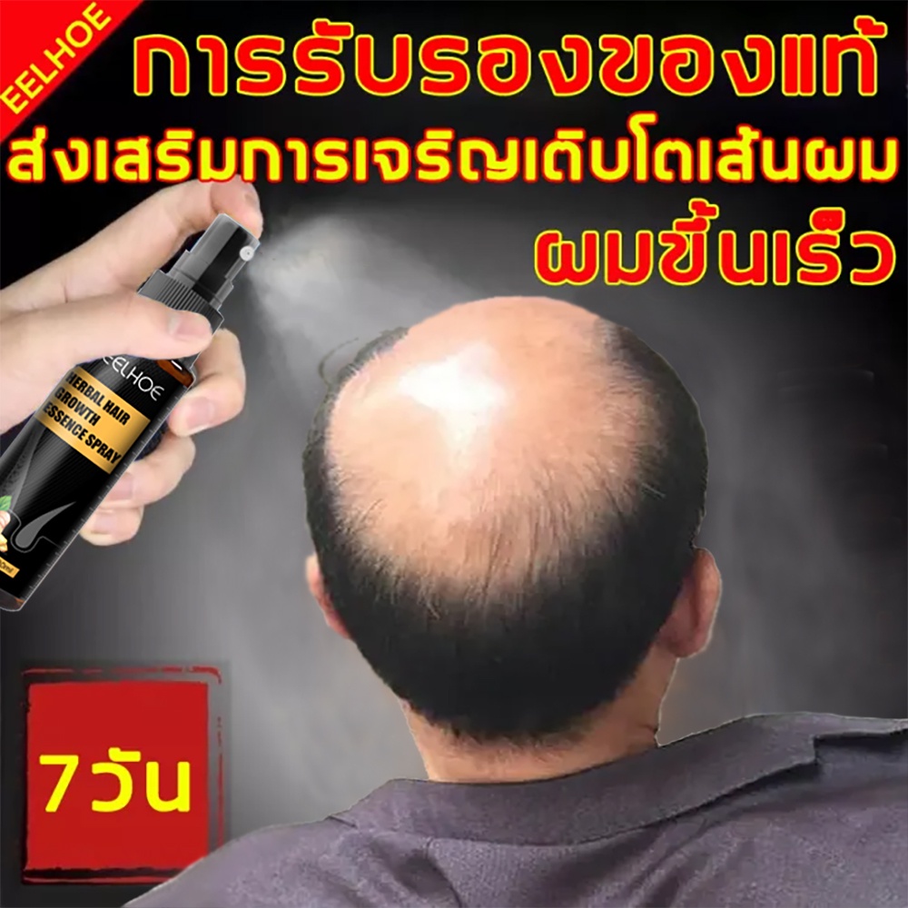 หมดปัญหาผมร่วง น้ำยาปลูกผม 30ML เร่งการงอกใหม่ ป้องกันไม่ให้ขิงหลุด รากผมแข็งแรง(น้ำยาปลูกผมผู้ชาย เซรั่มปลูกผม)