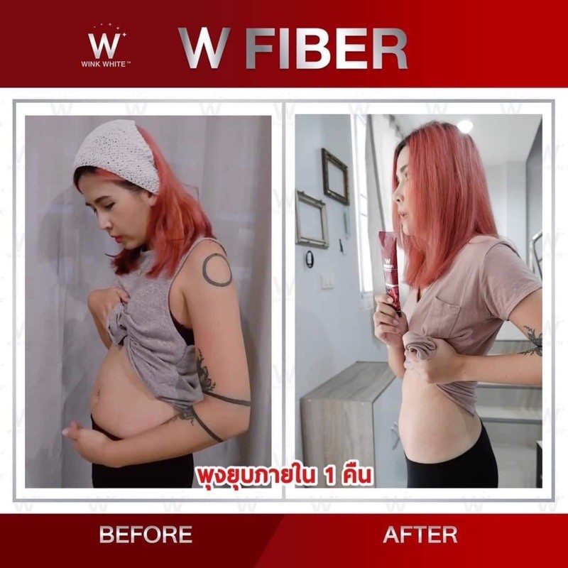 W FIBER ดับเบิลยูไฟเบอร์