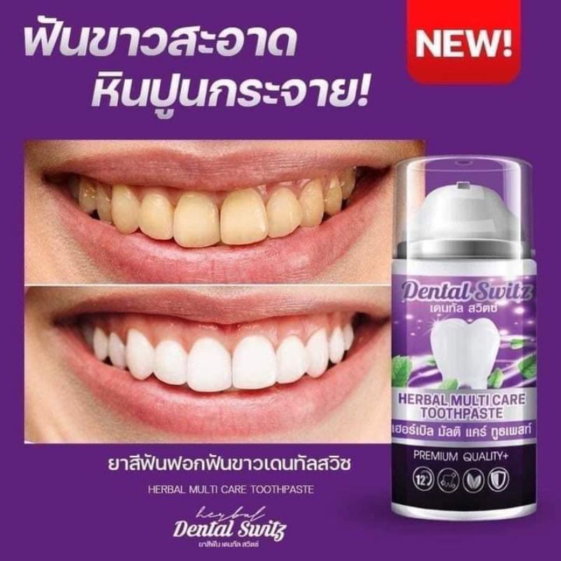 Dental switz ' เจลฟอกฟัน ตัวดัง💯✨