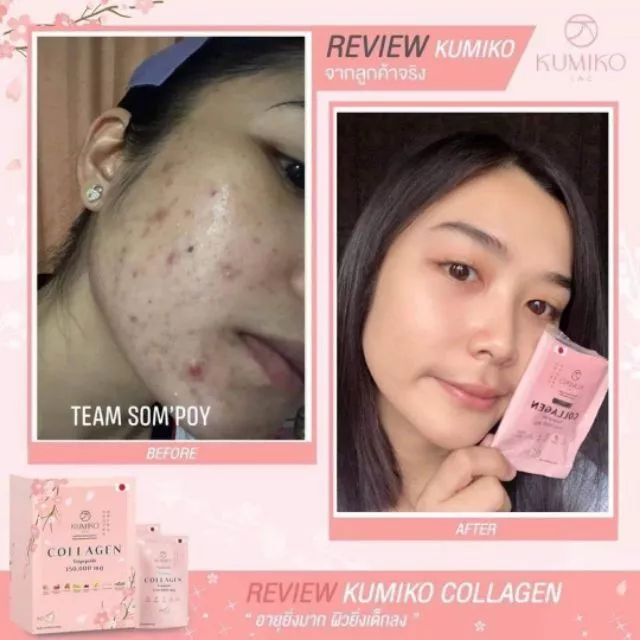 Kumiko Collagen คอลลาเจนพรีเมี่ยมจากญี่ปุ่น thumbnail 5
