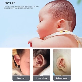 Byce> แผ่นแปะหู เทปซิลิโคน แก้ไขหู สําหรับเด็กทารก