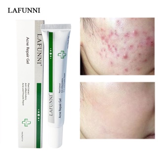 LAFUNNI เจลซ่อมแซมสิว ครีมกําจัดความเสียหาย ซ่อมแซมอย่างอ่อนโยน เซรั่มบํารุงผิวหน้า ป้องกันผิวบอบบาง รอยสิว ทรีตเมนต์ ดูแลผิว