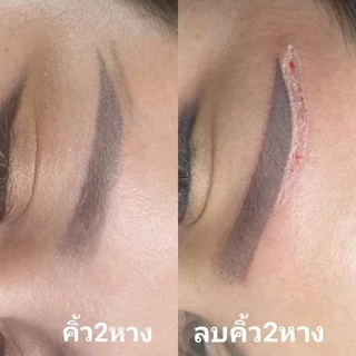 ผลิตภัณฑ์สำหรับลบรอยสัก ลบคิ้วปลิง คิ้วสองหาง