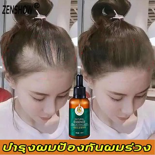 ZESSHOW เซรั่มแก้ผมร่วง 30ml สูตรลับของขิง บำรุงรากผม ควบคุมความมัน （แชมพูขิงเพียว ยาสระผมขิง ） hair loss serum