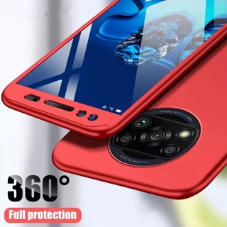 Case POCO X3 NFC เคสประกบหน้าหลัง แถมฟิล์มกระจก1ชิ้น เคสแข็ง เคสประกบ 360 องศา