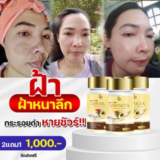 ✅ของแท้💯จากบริษัท zincolta ซินคอลต้า น้ำมันอาโวคาโดสกัดเย็น คอลลาเจน สิว ฝ้ากระ ผิวแห้ง วัยทอง ไขมันในเลือด ความดันสูง