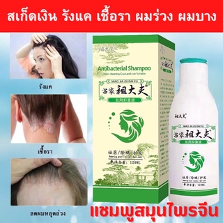 💢ส่งจากไทย แชมพูสมุนไพร Zudaifu แชมพูสระผมขจัดรังแค ลดผมร่วง เชื้อราบนหนังศรีษะ สะเก็ดเงิน บำรุงเส้นผมและหนังศรีษะ