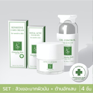 🚚 พร้อมส่ง Oranucha Skin เซตสำหรับผิวมัน เป็นสิวเรื้อรังเยอะมาก 4 ชิ้น [ออร่านุชา สกิน]