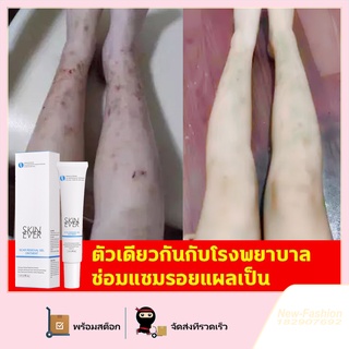 ครีมลบแผลเป็น ครีมลดรอยแผลเป็น 30g ลดแผลไฟไหม้ แผลน้ำร้อนลวก แผลผ่าตัดเป็นต้น แผลเป็นหลายประเภท ยาลบลอยแผลเป็น ครีมลดแผลเป็น น้ำร้อนลวก แผลเป็นจากยุงกัด ครีมแก้ขาลาย ครีมลบรอยแผลดำ ครีมทาแผลรอยดำ ลบรอยแผลเป็นอย่างรวดเร็ว