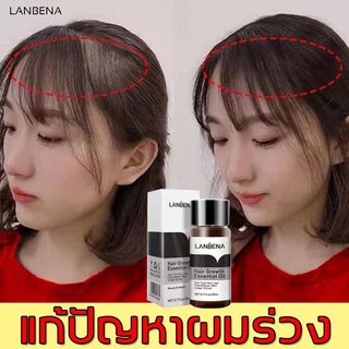 ac LANBENA เซรั่มปลูกผม 20ml ป้องกันผมร่วง เซรั่มปลูกผม รักษาผมร่วง เซรั่มใส่ผม ปลูกผม น้ำยาเร่งผมยาว ยาปลูกผม