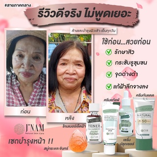 ✨ส่งฟรี✨เซ็ตรักษาสิว ฝ้าหนา ลดกระจุดด่างดำ บำรุง พร้อมปกป้อง ฟื้นฟูผิว ไร้สารอันตราย