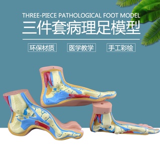 โมเดลหุ่นอนาโตมี่ Normal Foot Flatfoot Bow Foot Model Foot Pathology Model Human Foot Muscle Anatomy Model