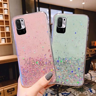 เคสโทรศัพท์  Redmi Note 10 5G Starry sky Soft tpu Phone case Xiomi Redmi Note10 5G Housing shell