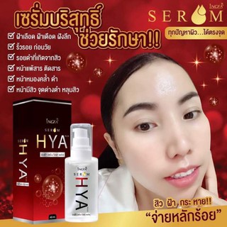 ไฮยาอิงฟ้า เซรั่มไฮยาอิงฟ้า HYA SERUM INGFA